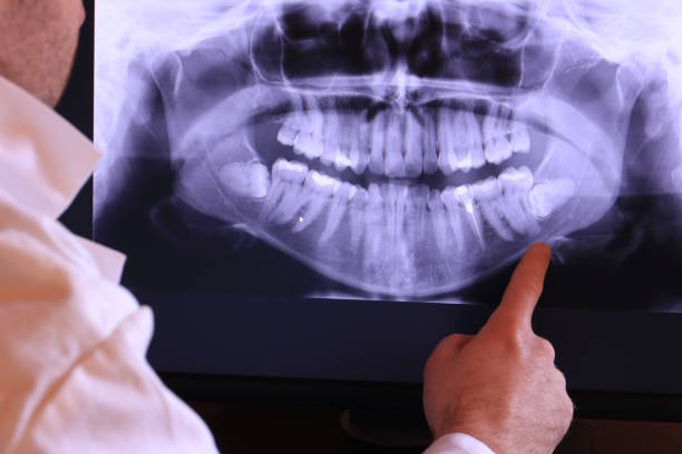 Best Emergency Dentist for Knocked-Out Tooth in Verona Walk, FL